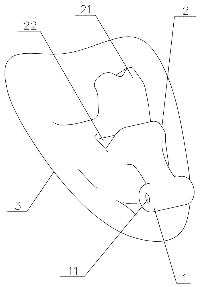 Personalized orthodontic appliance having orthoaxis function