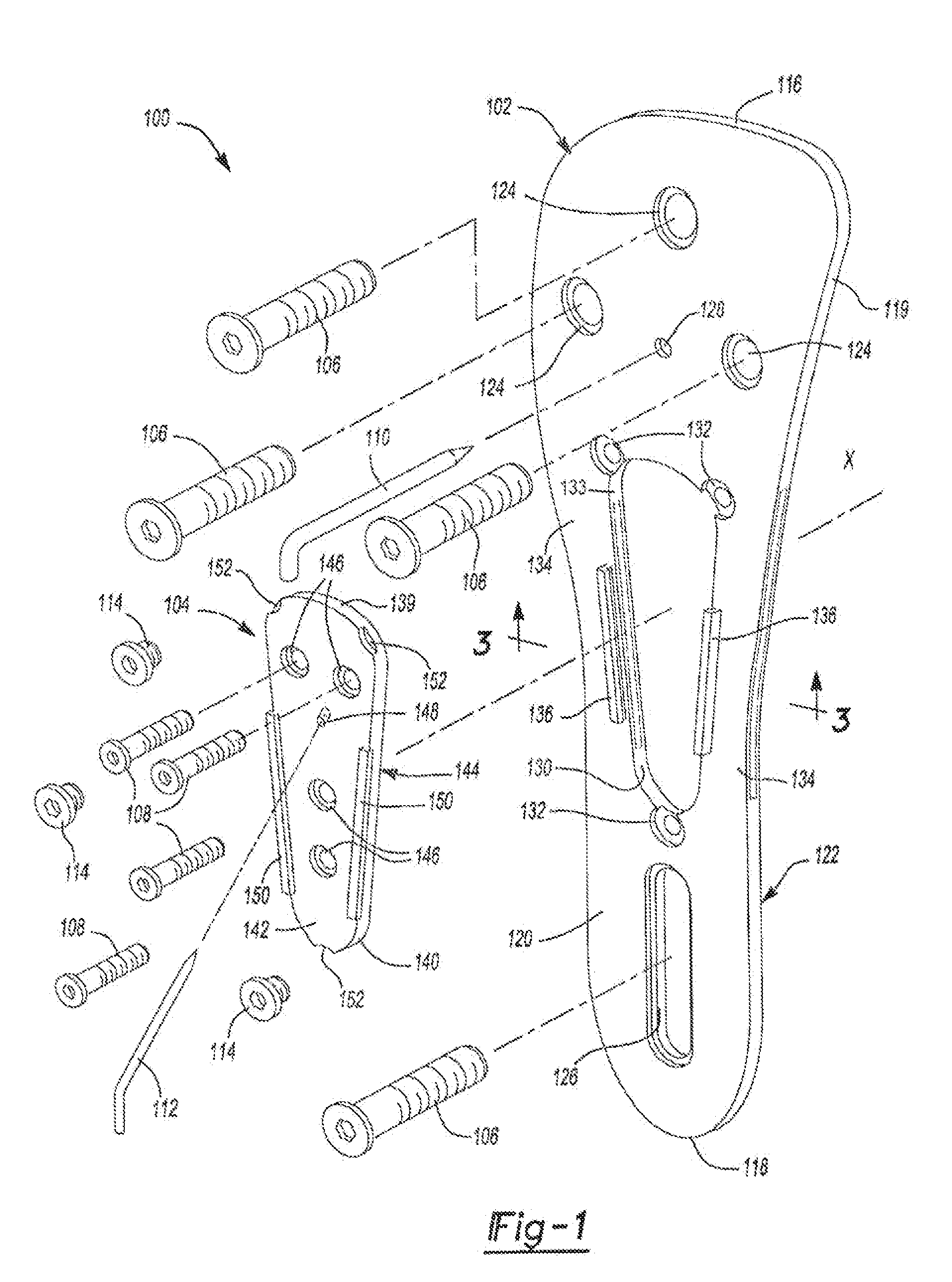 Method and apparatus for osteosynthesis