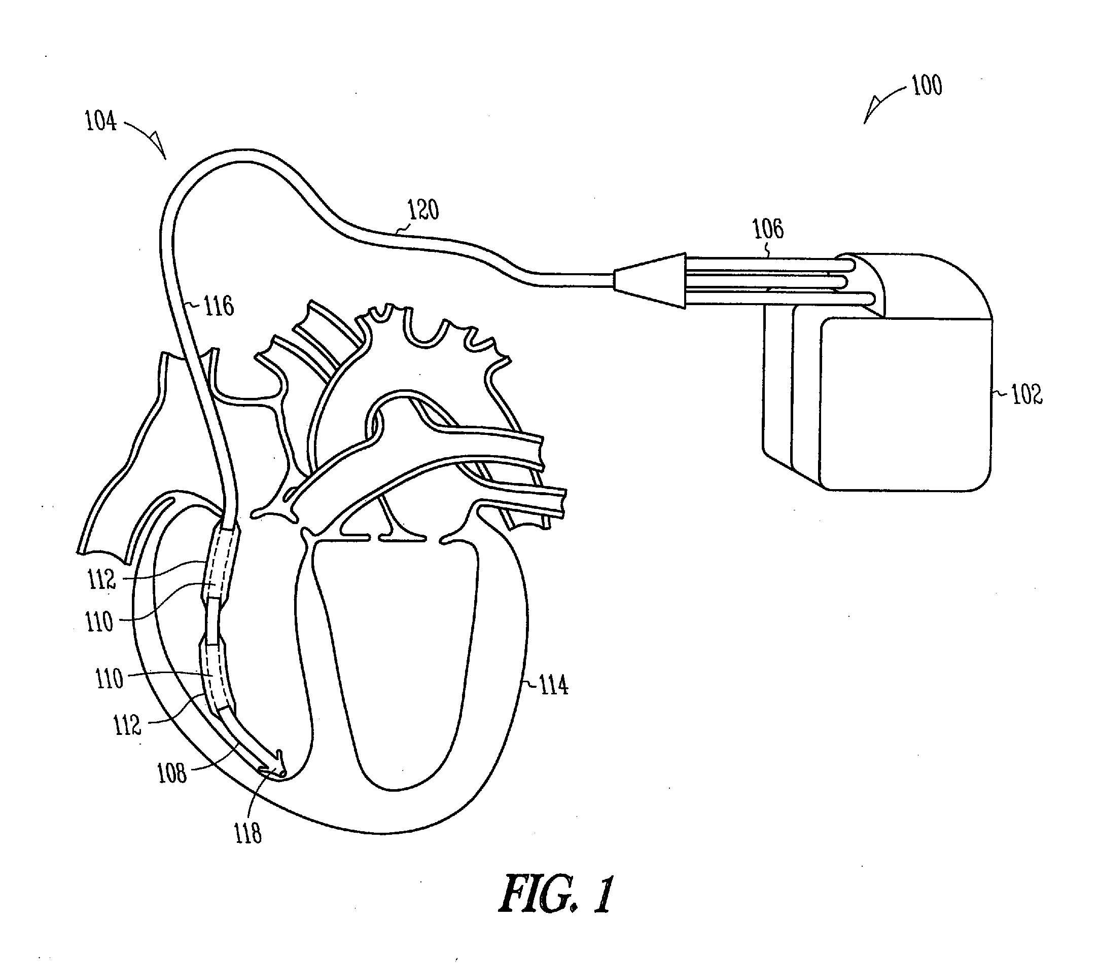 Fibrosis-limiting material attachment
