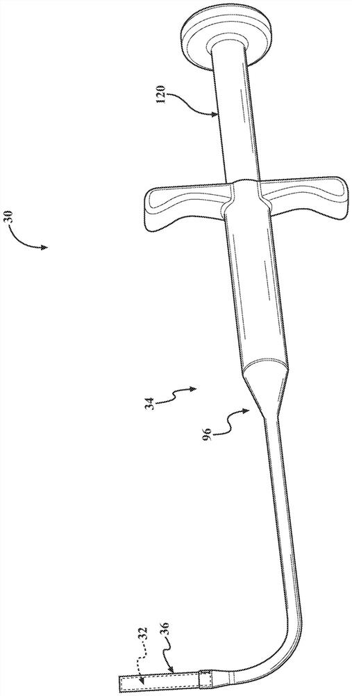 Sinus stent and system and method of deploying stent within sinus of patient