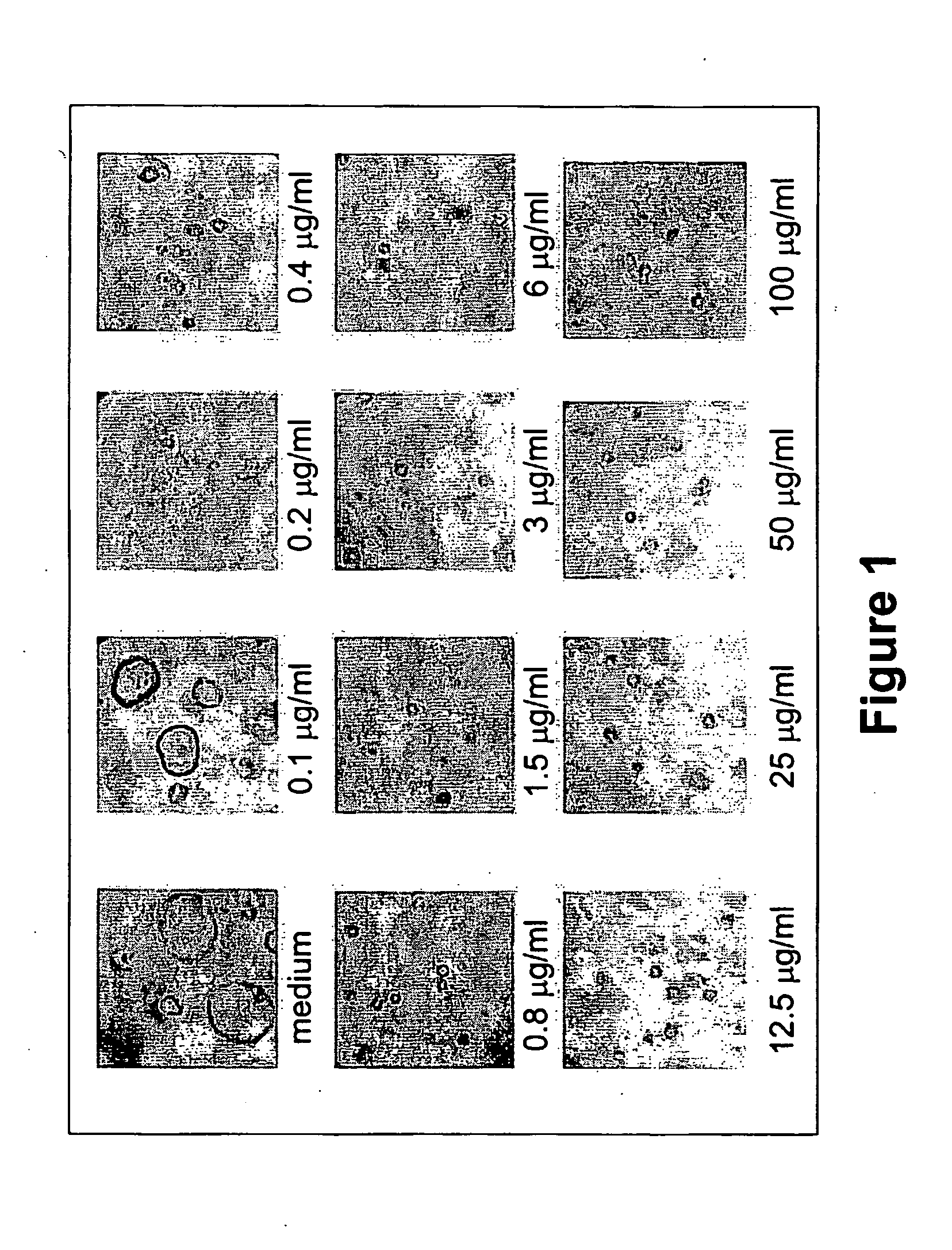 Methods and compositions for the treatment of polycystic diseases