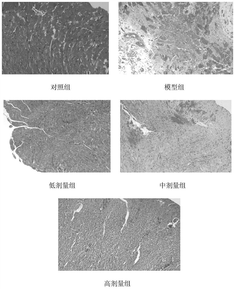 A kind of Zhuang medicine formula for treating coronary heart disease and its preparation method