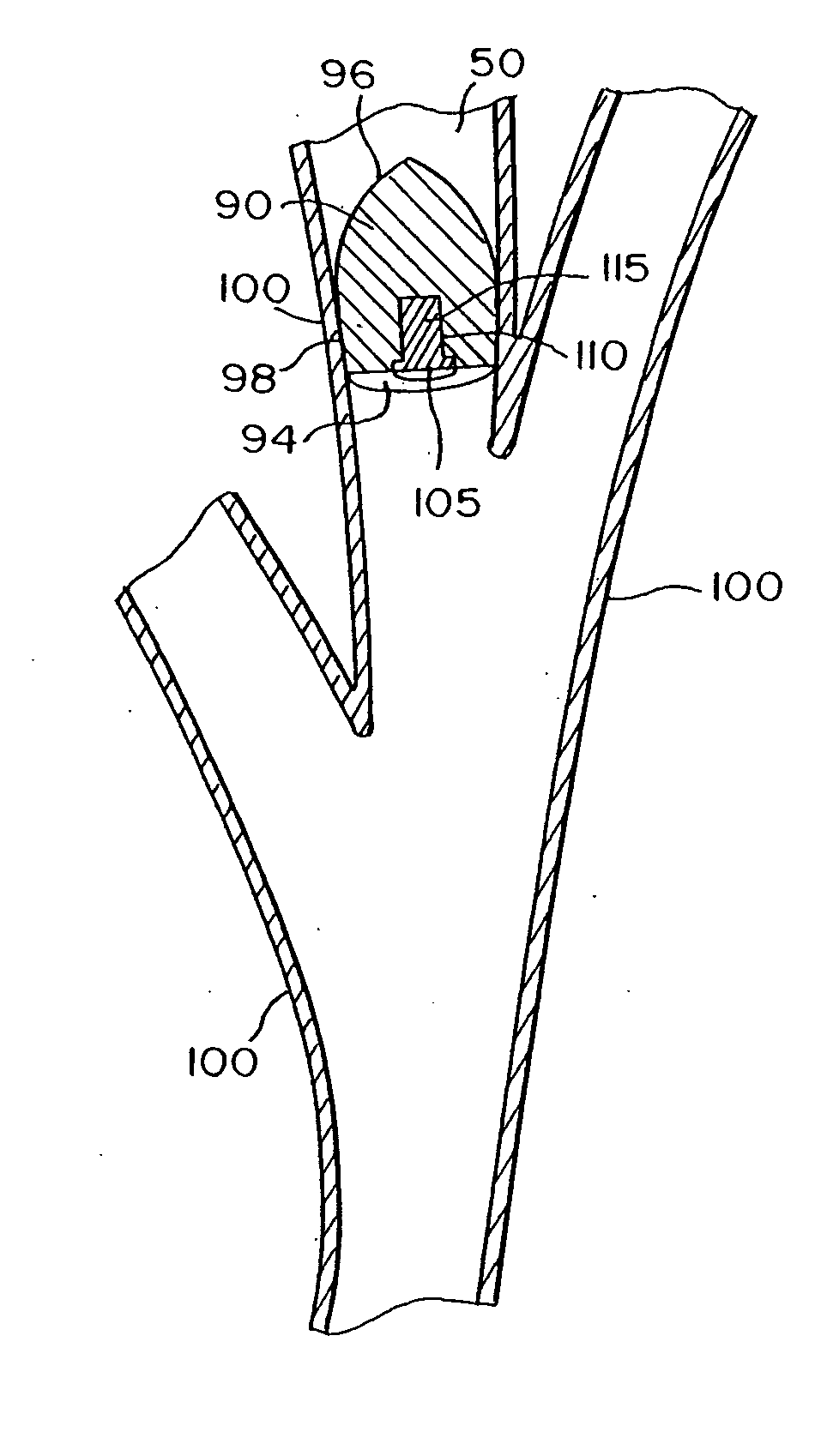 Intra-bronchial obstructing device that controls biological interaction with the patient