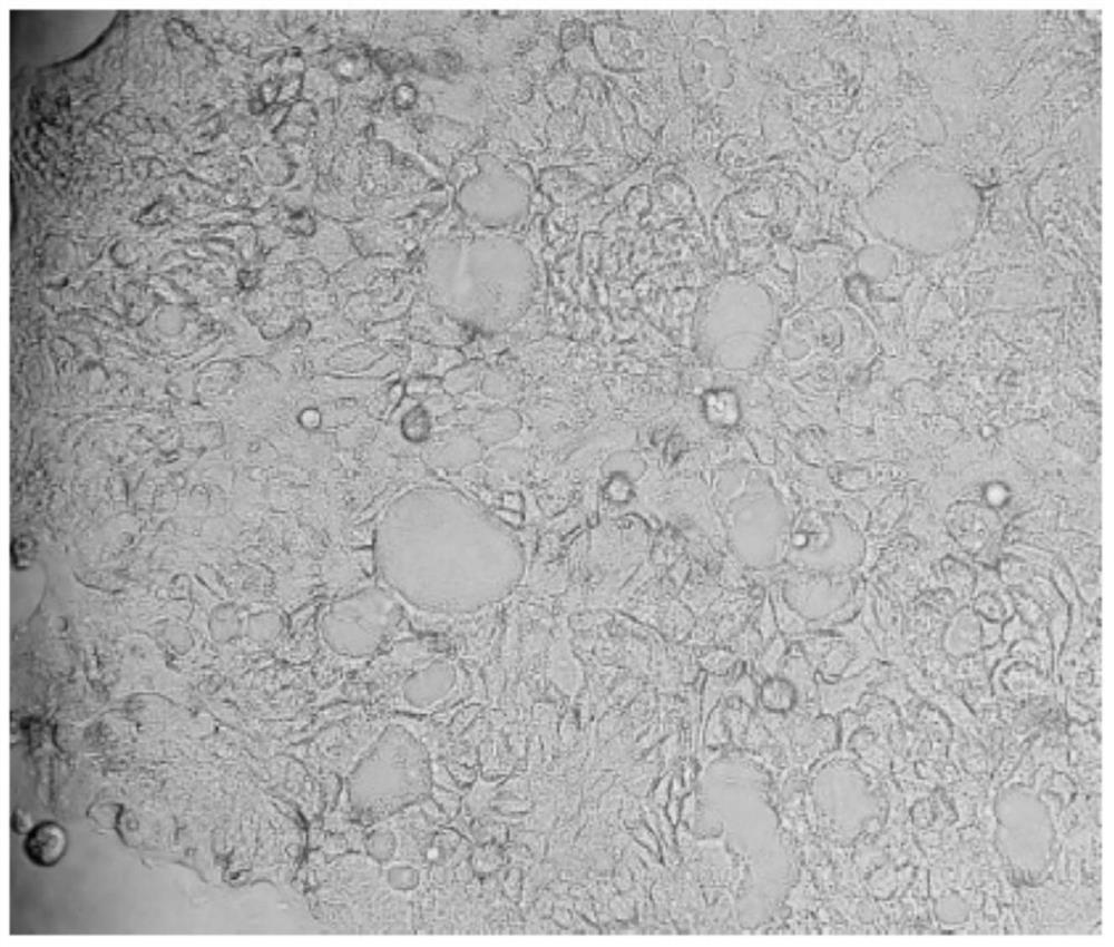 A human intrahepatic cholangiocarcinoma cell line with high tumorigenic ability and its application
