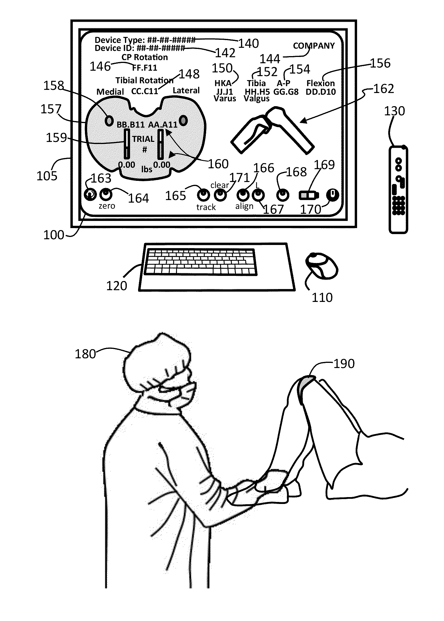 Method to measure medial-lateral offset relative to a mechanical axis