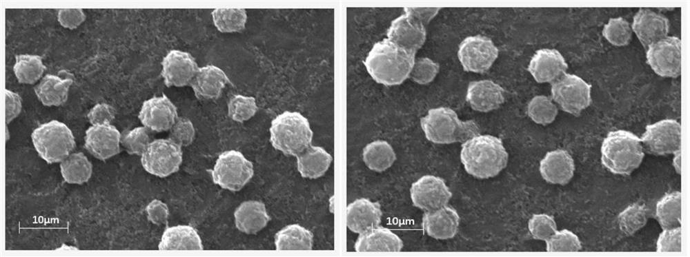 A kind of rivaroxaban suspension and preparation method thereof