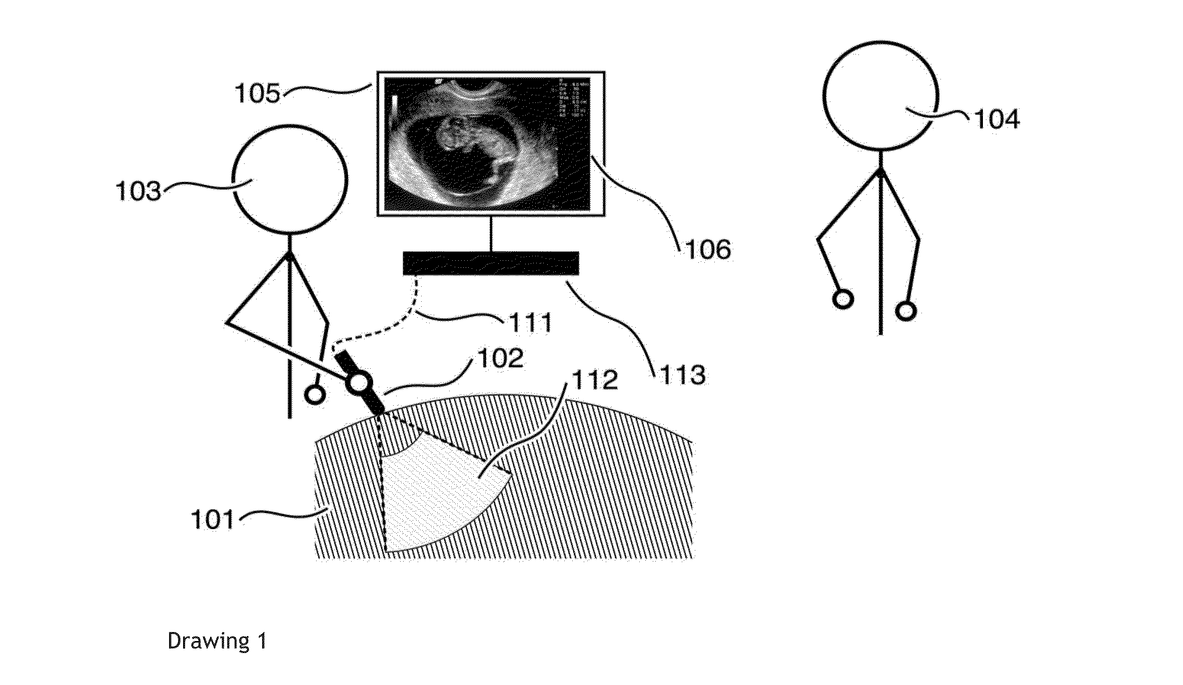 Apparatus and method for distributed ultrasound diagnostics