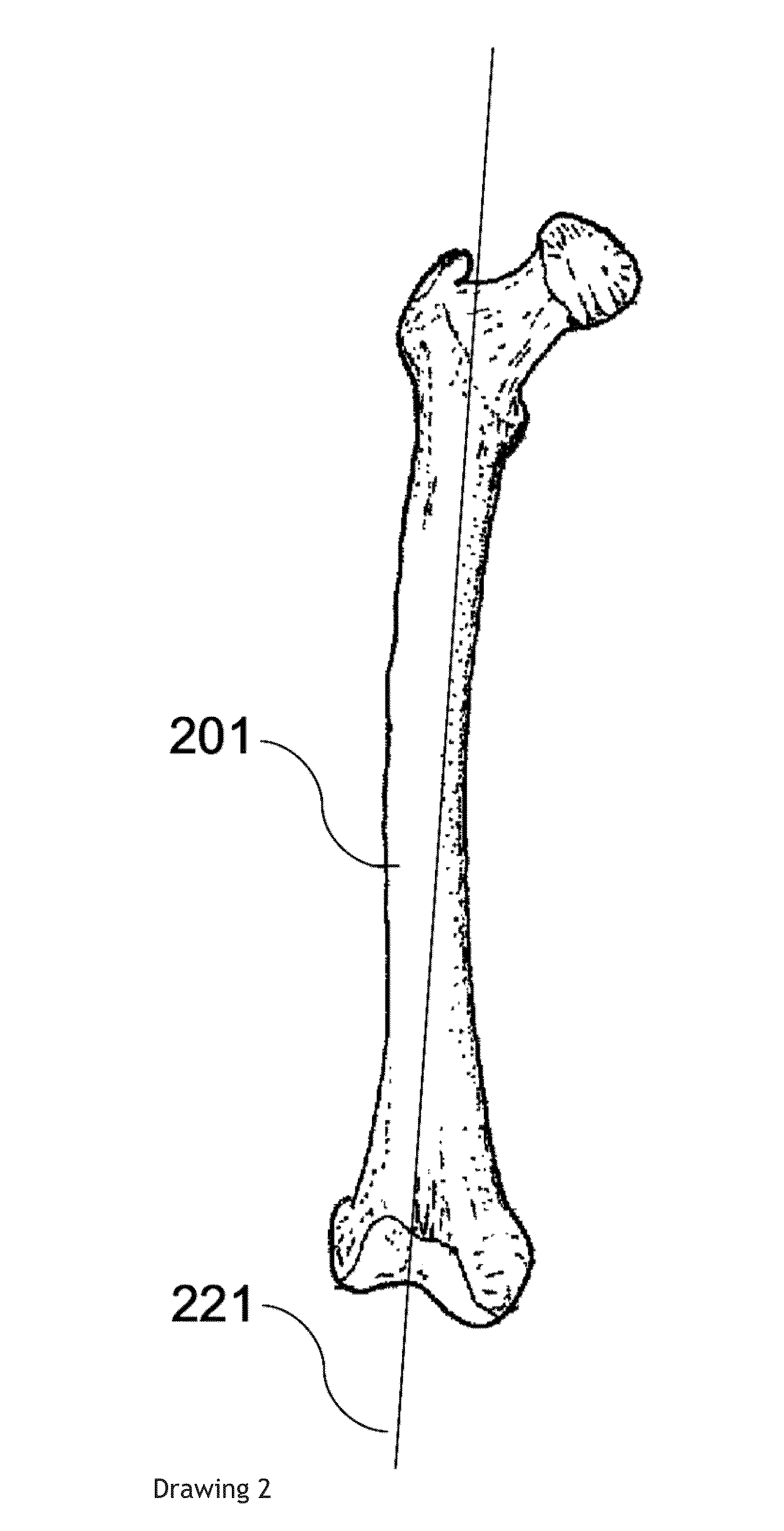 Apparatus and method for distributed ultrasound diagnostics