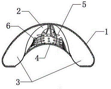 Breast augmentation prosthesis