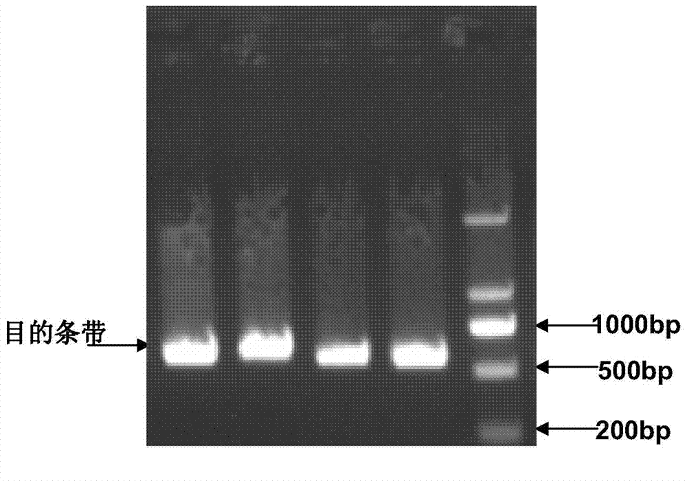 Method and primer for detection of polymorphic site of seventh exon of WT1 gene