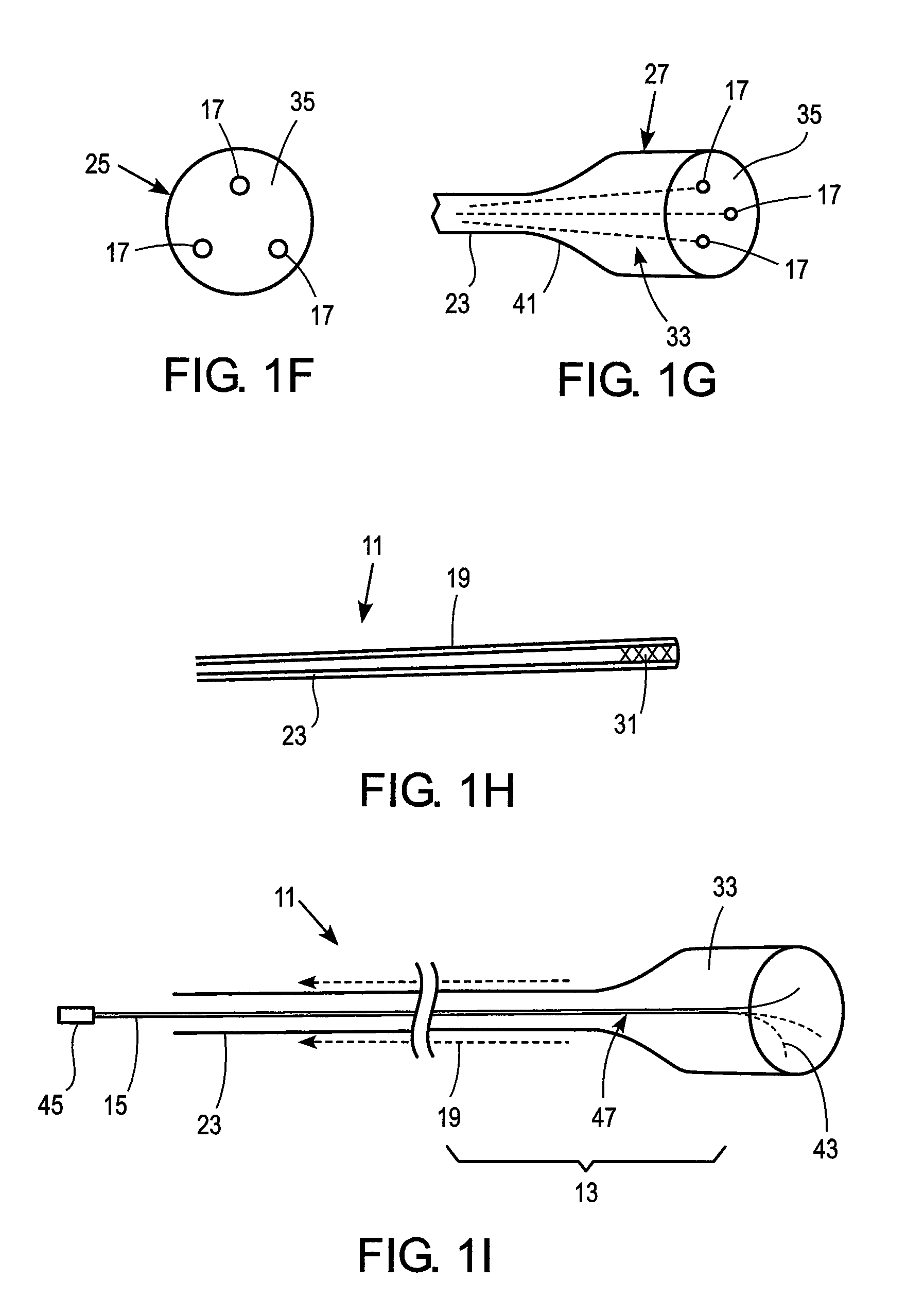 Catheter apparatus and methods for treating vasculatures