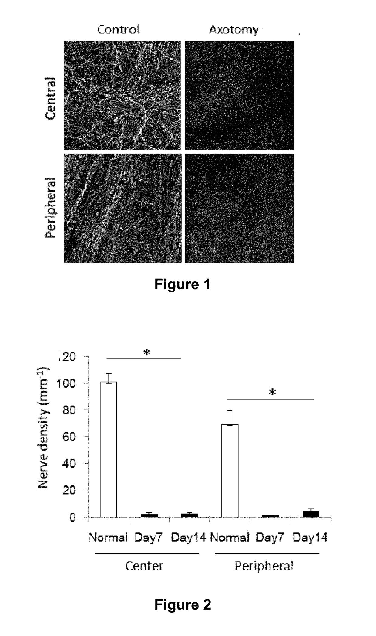 Methods of reducing corneal endothelial cell loss