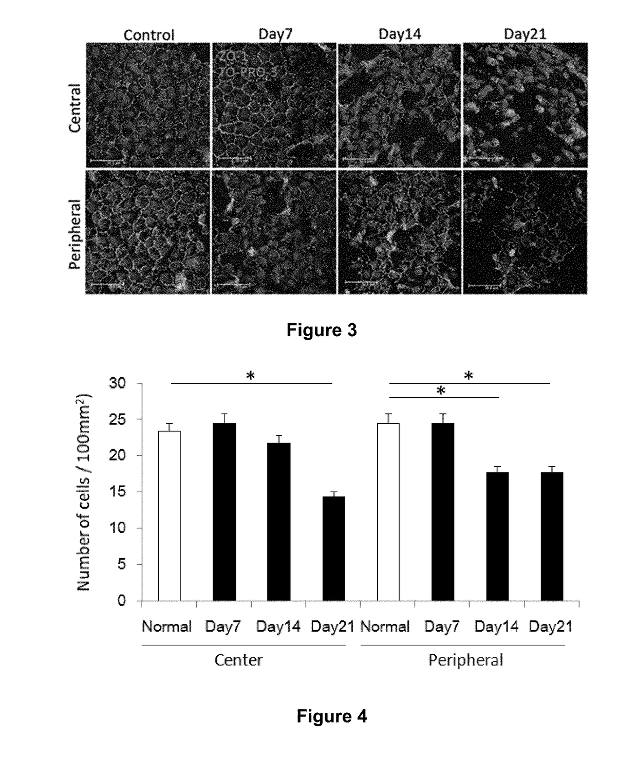 Methods of reducing corneal endothelial cell loss