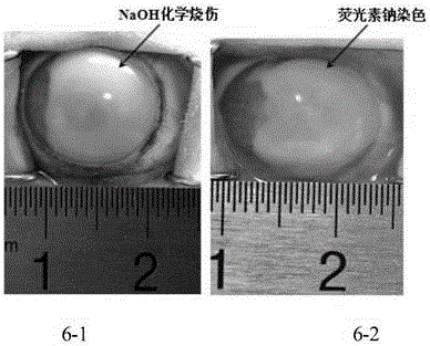 Application of umbilical cord mesenchymal stem cells to preparation of stem cell preparation for treating corneal injury