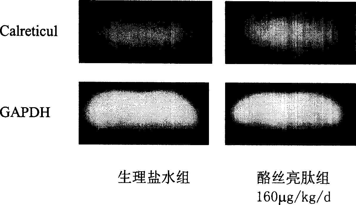 Method for detecting anti-liver cancer efficacy of tyroserleutide, kit and gene chip used thereby