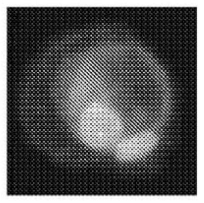 Compositions and methods relating to macrophages and/or monocytes with adhered particles