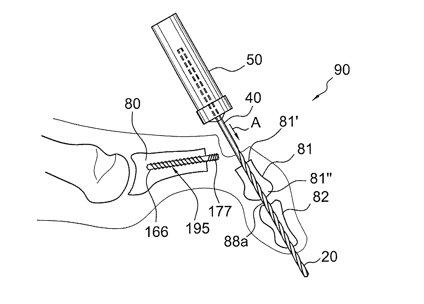 Drill/driver hybrid instrument for interphalangeal fusion