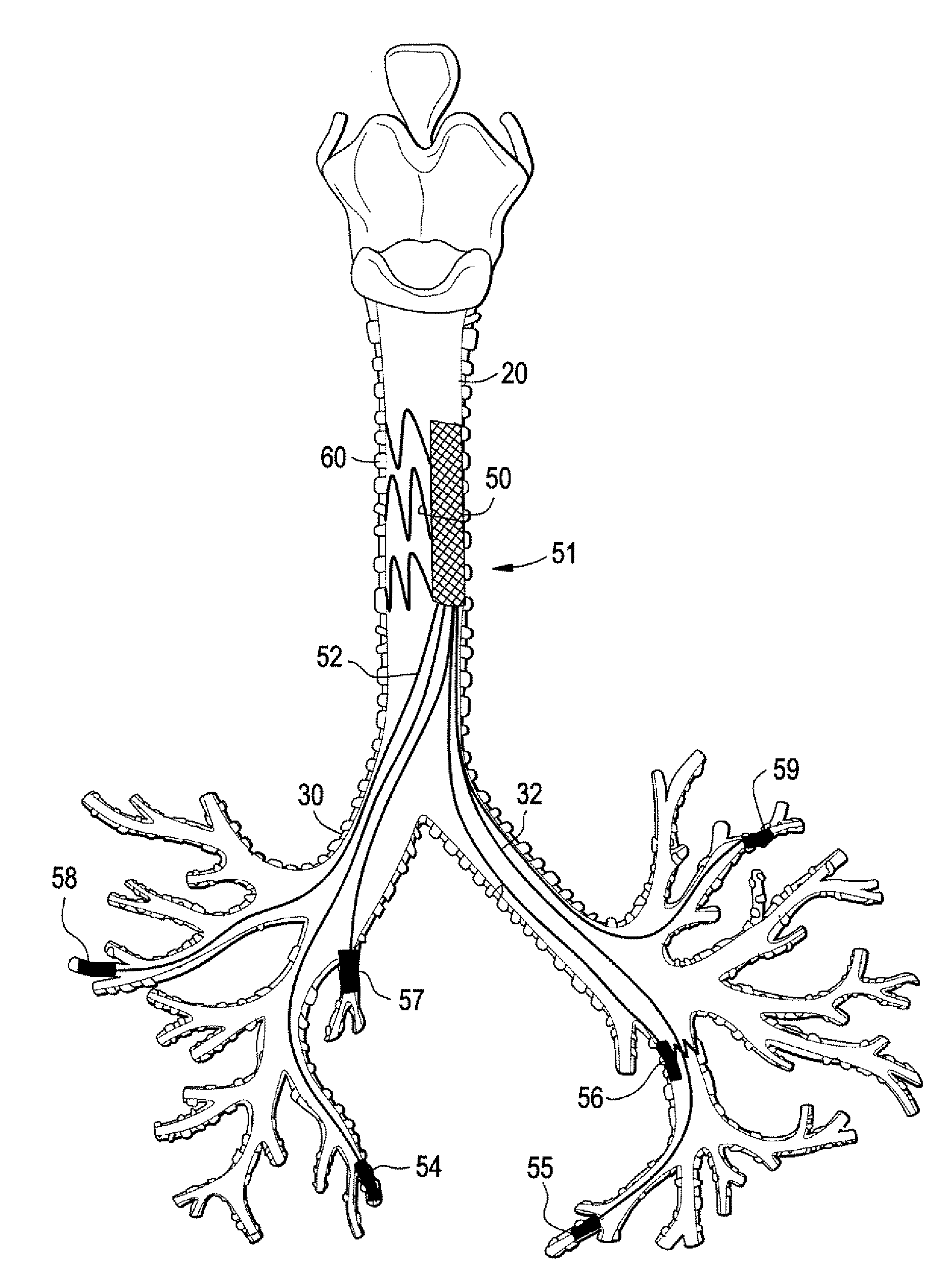 Implantable Devices And Methods For Stimulation Of Cardiac And Other Tissues
