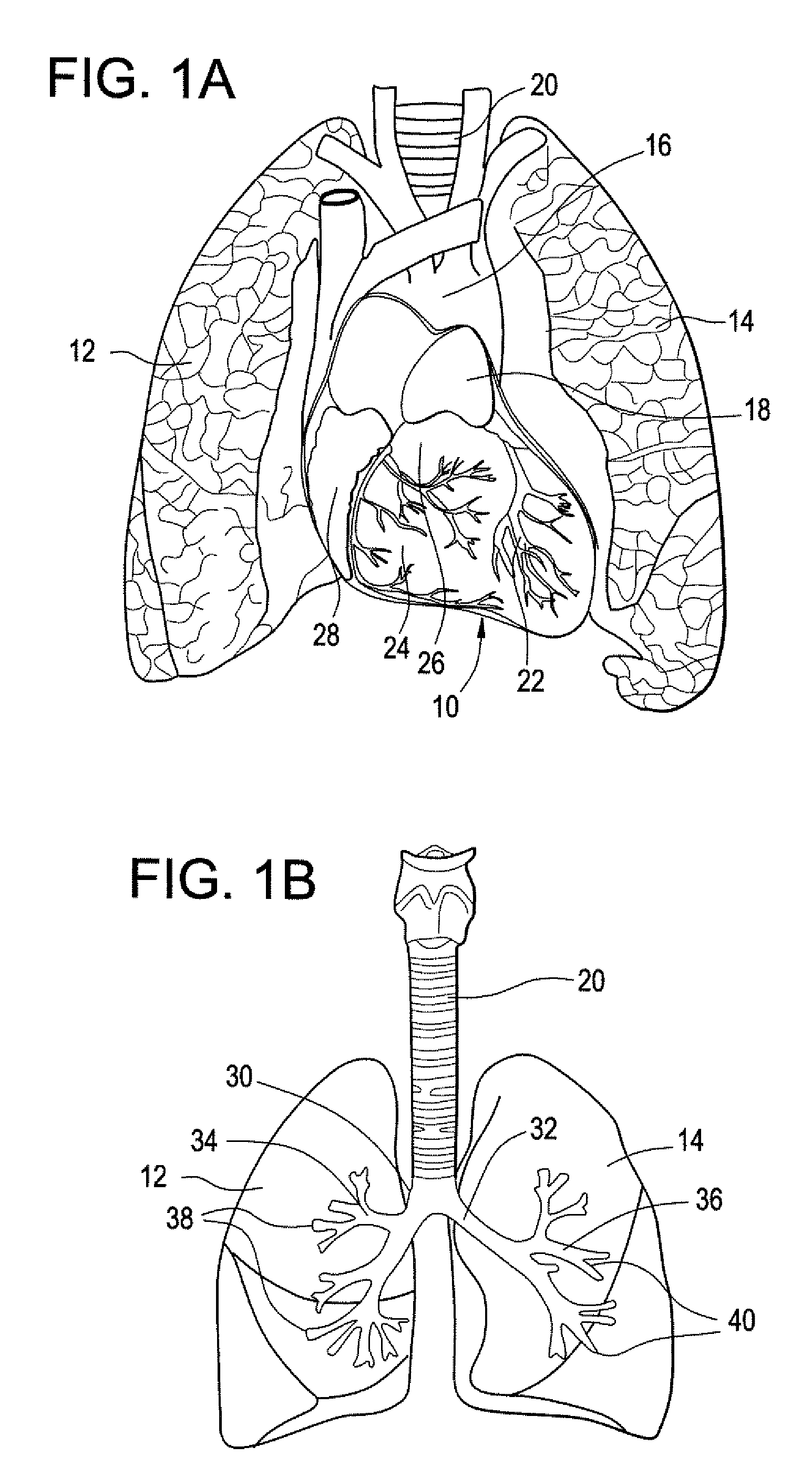 Implantable Devices And Methods For Stimulation Of Cardiac And Other Tissues