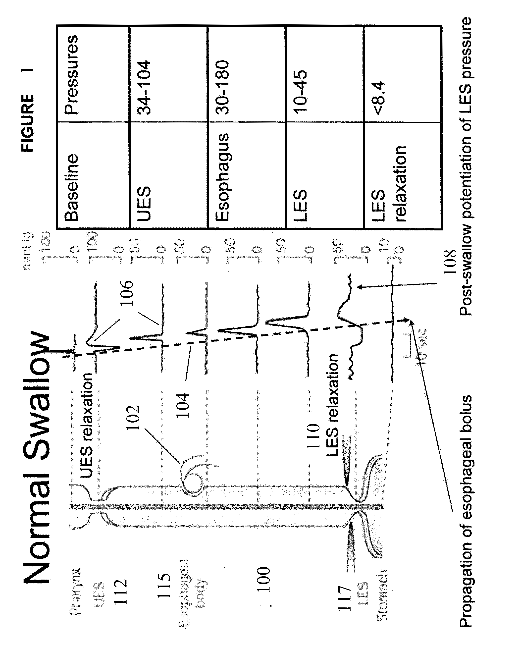 Device and implantation system for electrical stimulation of biological systems