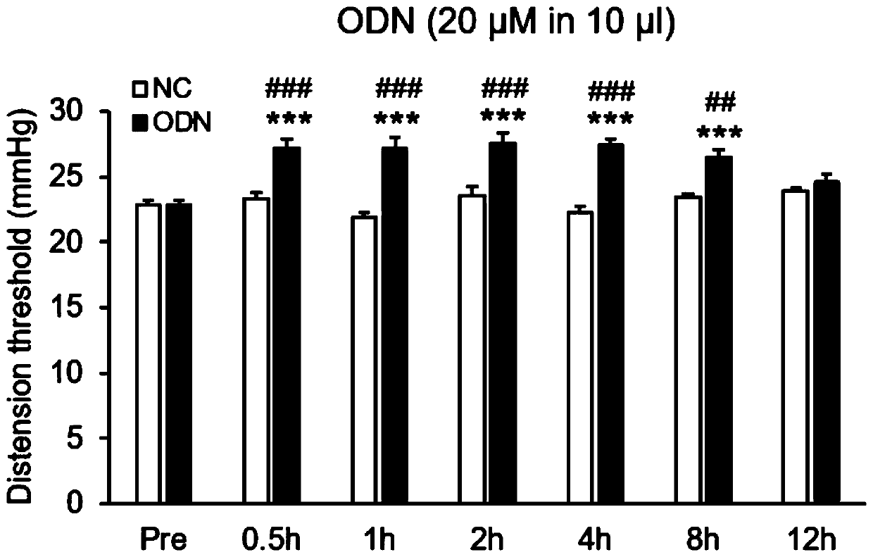 Oligodeoxyribonucleotide for relieving chronic visceral pain sensitivity of irritable bowel syndrome