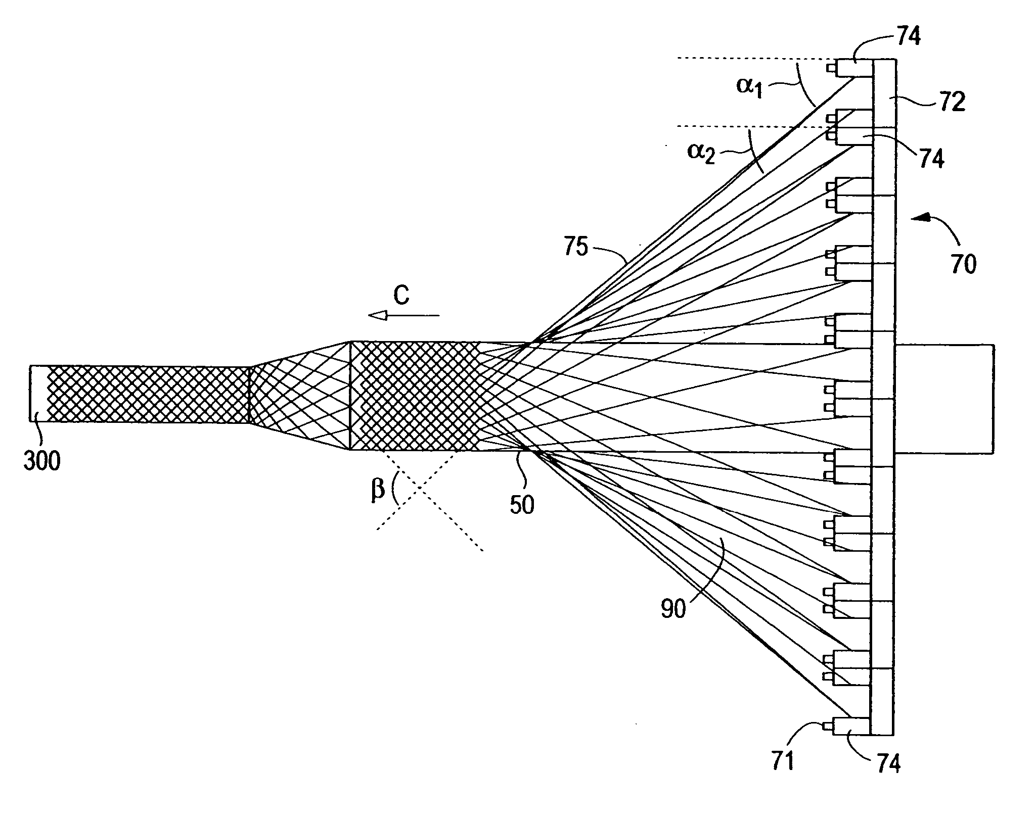 Braided stent and method for its manufacture