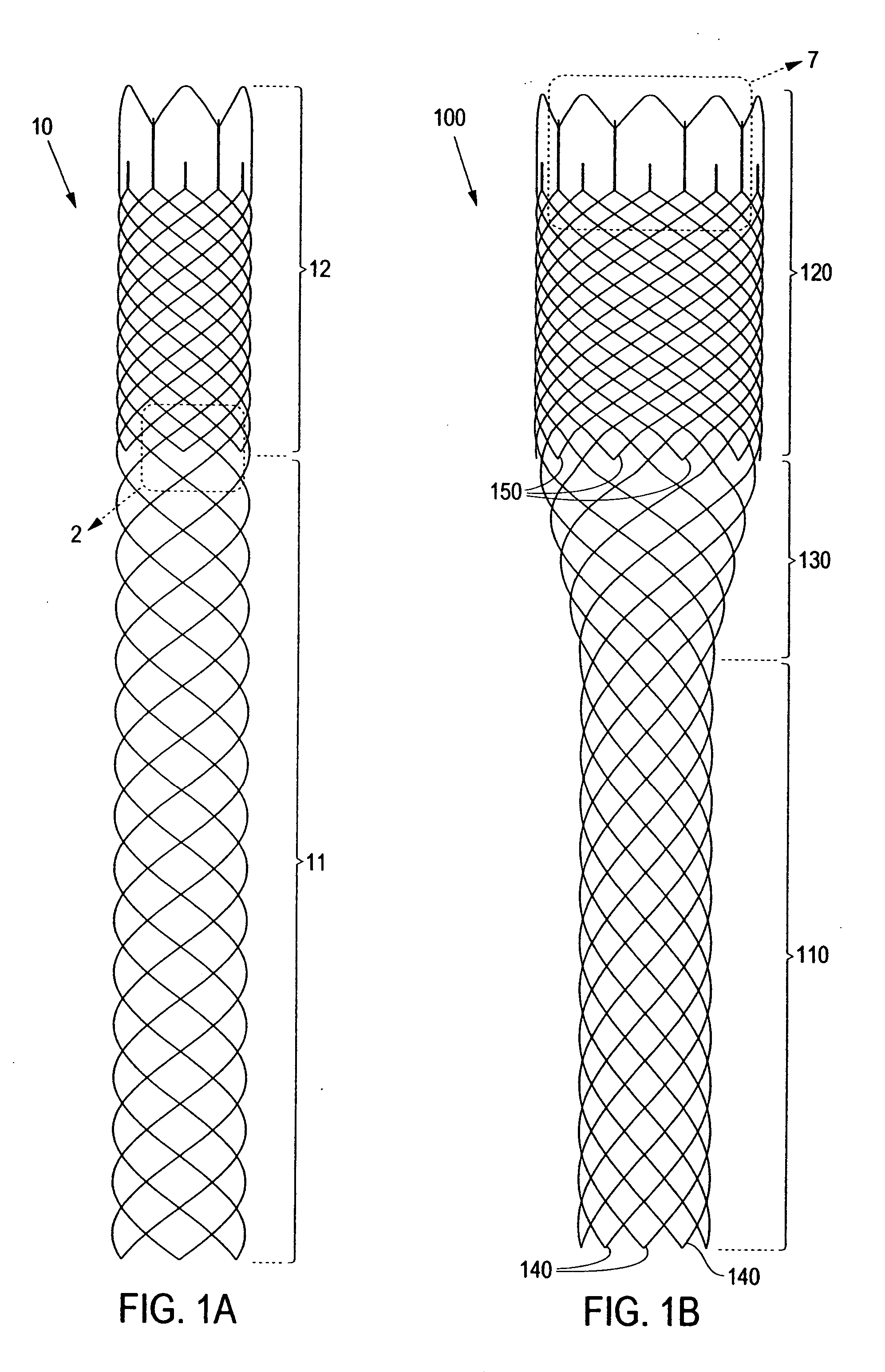 Braided stent and method for its manufacture