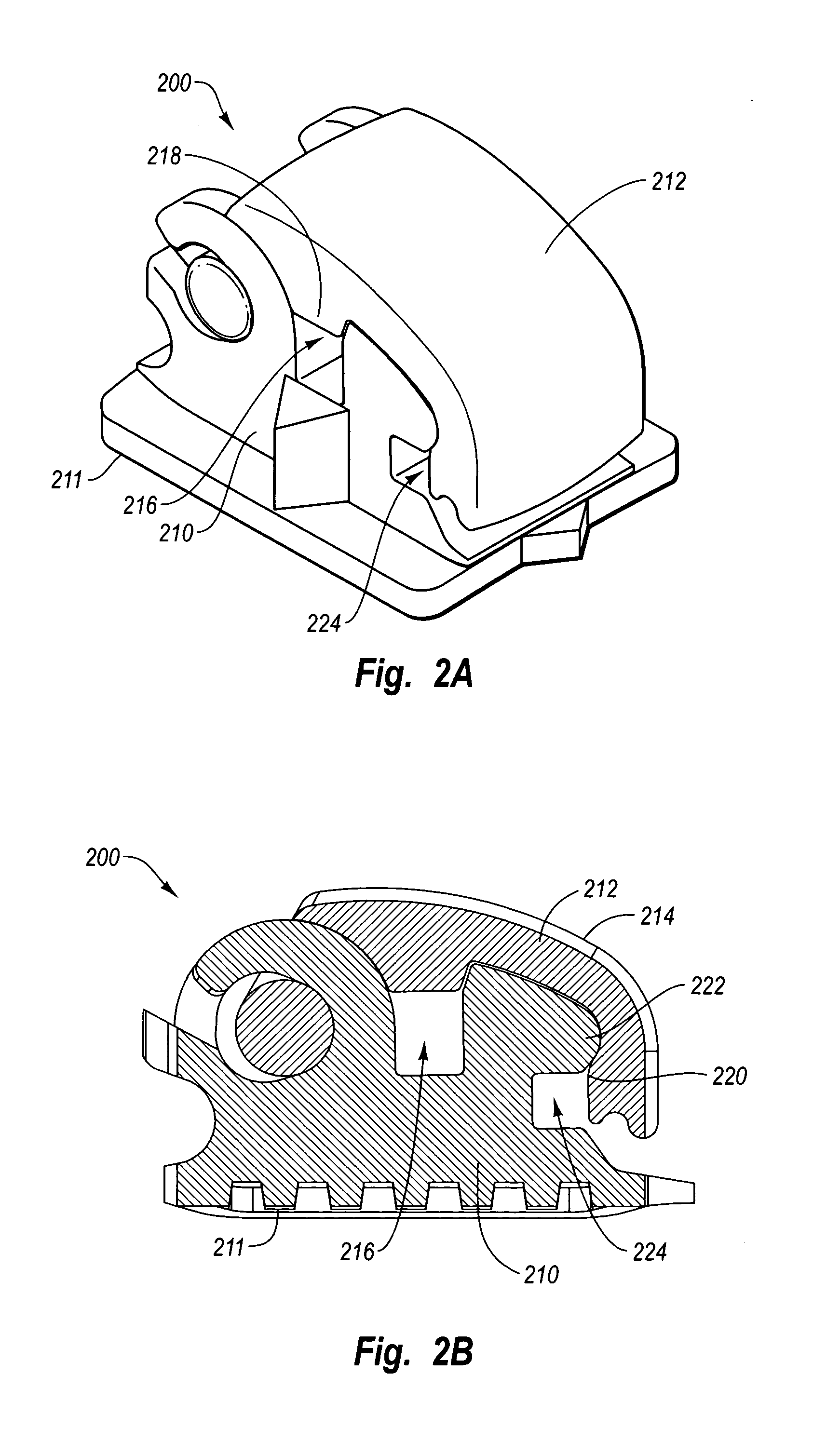 Orthodontic bracket system comprising multiple brackets having multiple aligned slots