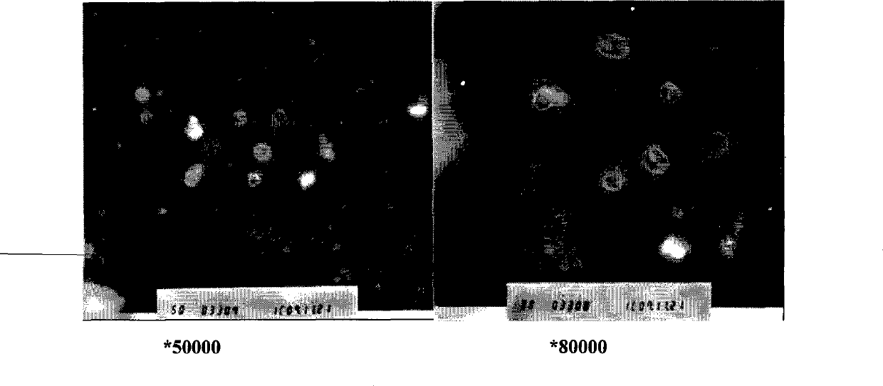 Apitoxin liposome preparation and preparation method thereof