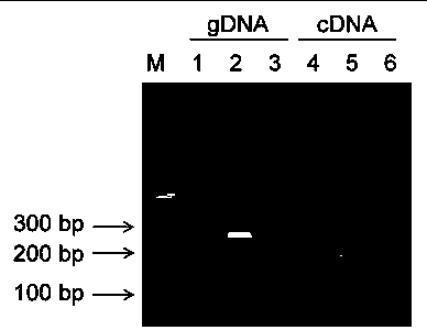 Cyclic RNA circBCBM1 and non-diagnostic fluorescent quantitative detection method