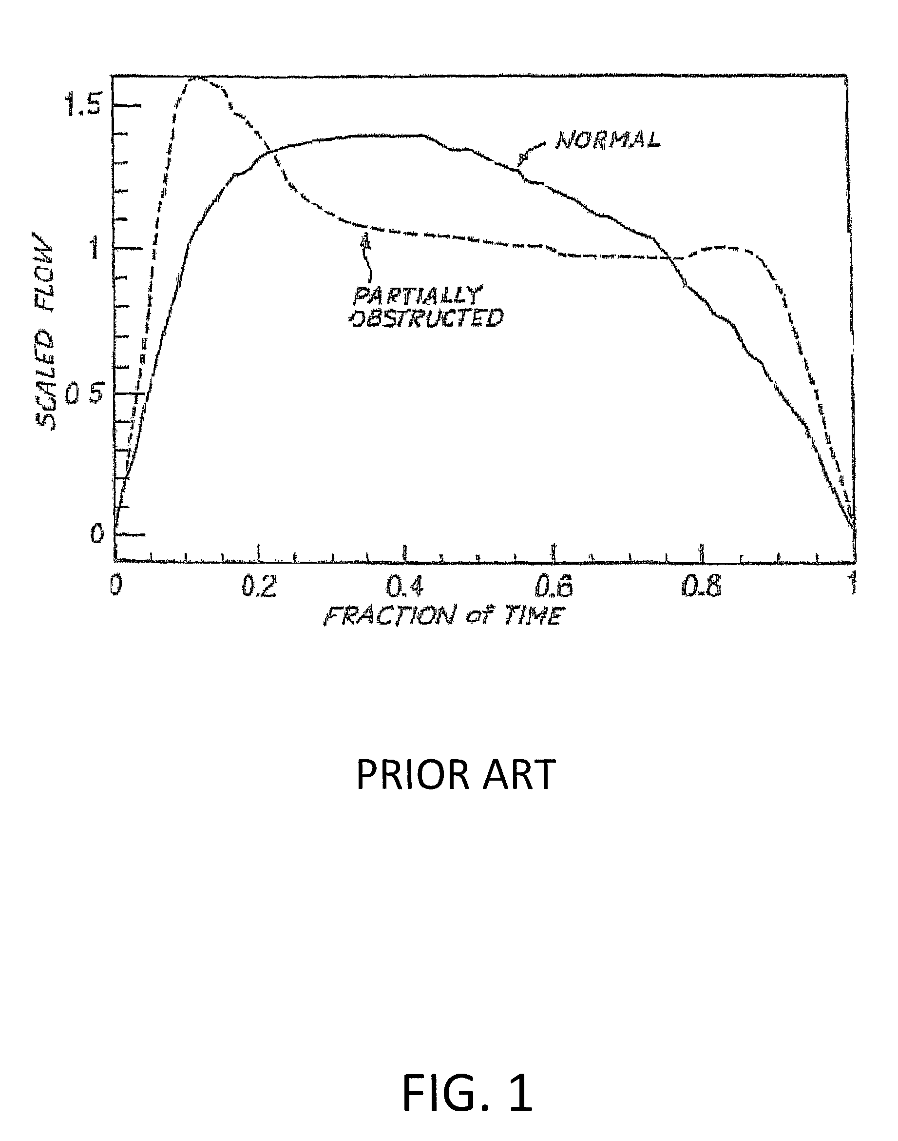 Method and apparatus for resolving upper airway obstruction, resistance or instability