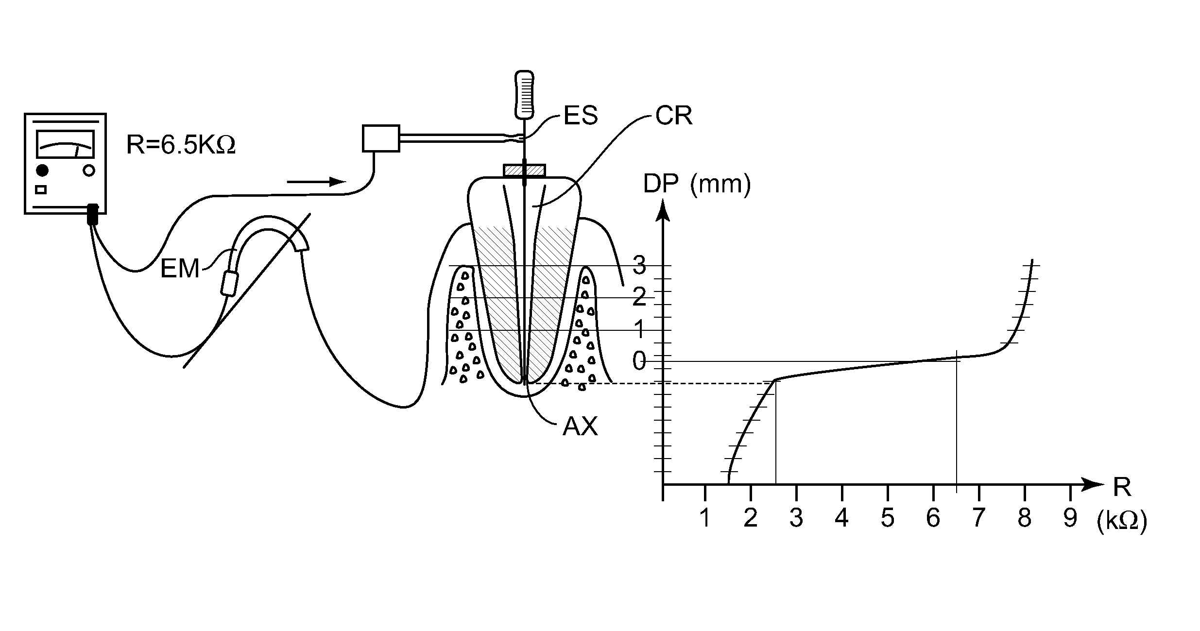 Method and device for determining the apical position in a dental root canal