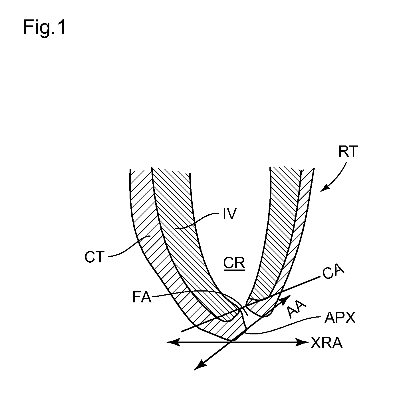 Method and device for determining the apical position in a dental root canal