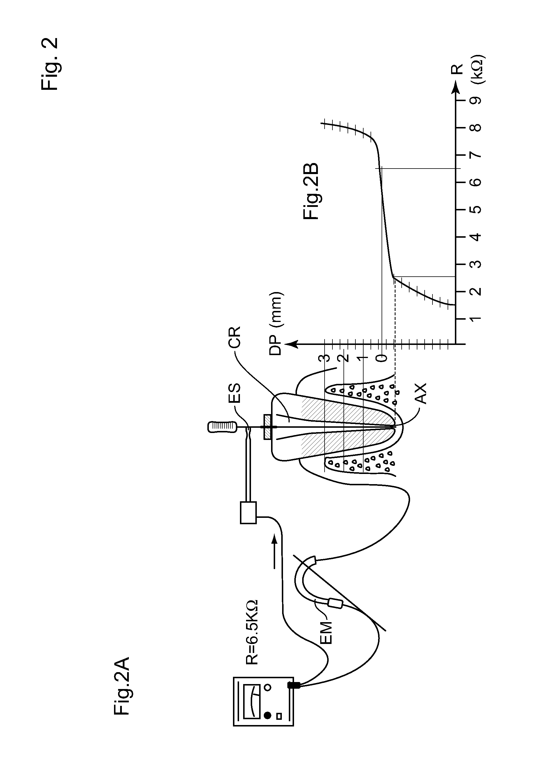 Method and device for determining the apical position in a dental root canal