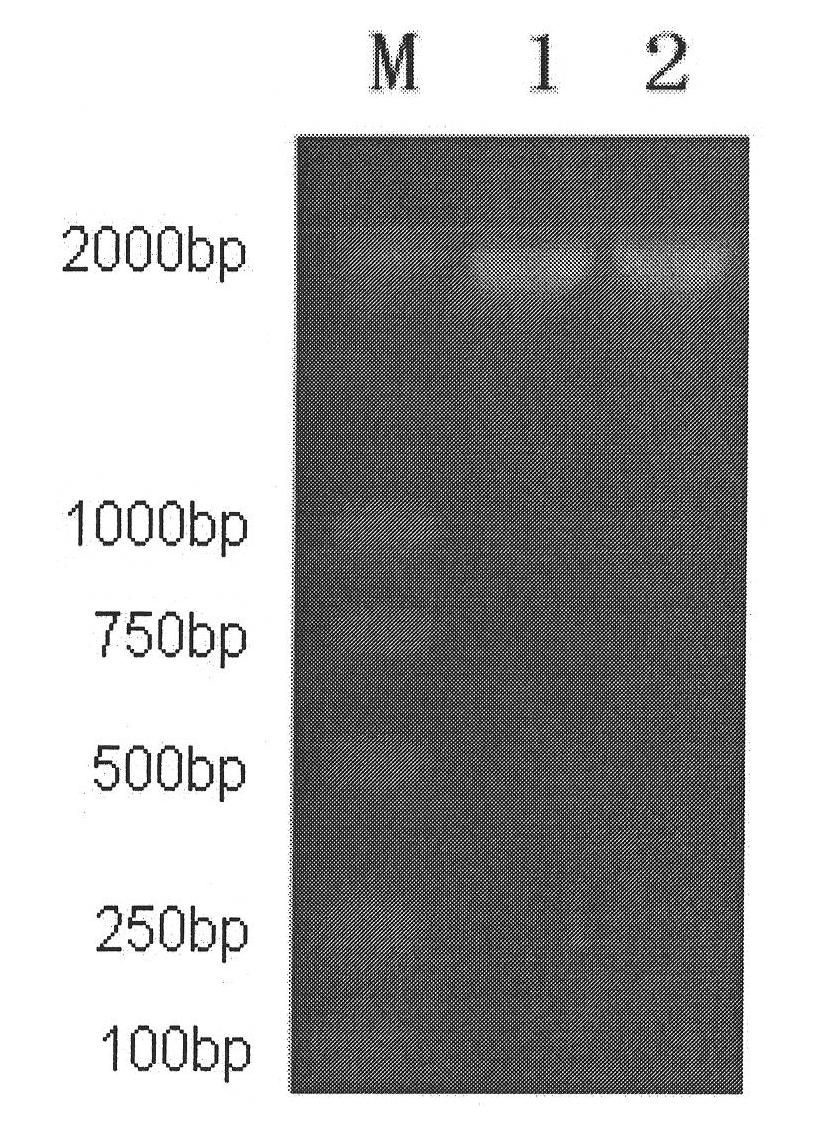 Kit for amplifying herpes simplex virus (HSV)-1 alkali nuclease gene and method for expressing HSV-1 alkali nuclease