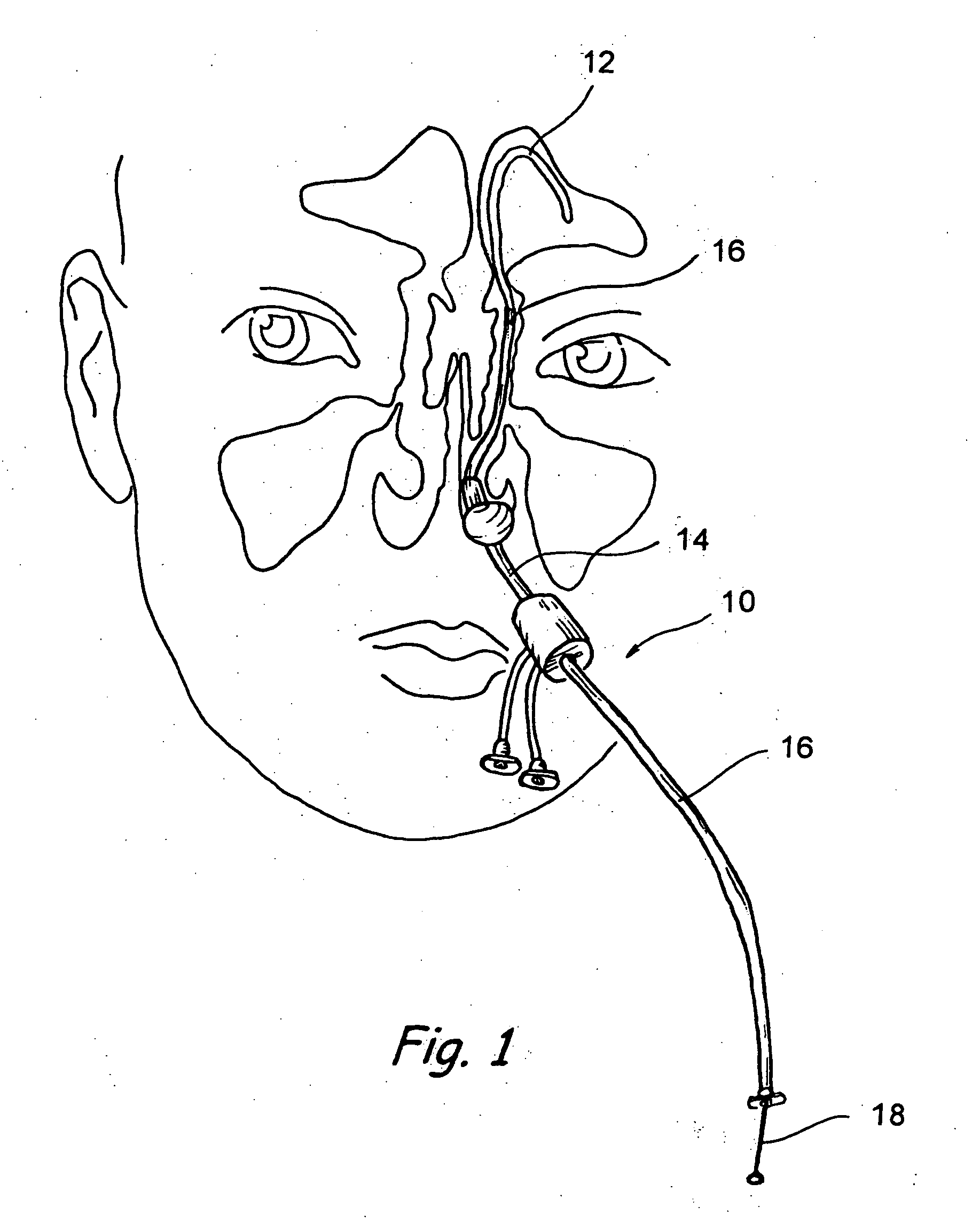 Implantable device and methods for delivering drugs and other substances to treat sinusitis and other disorders