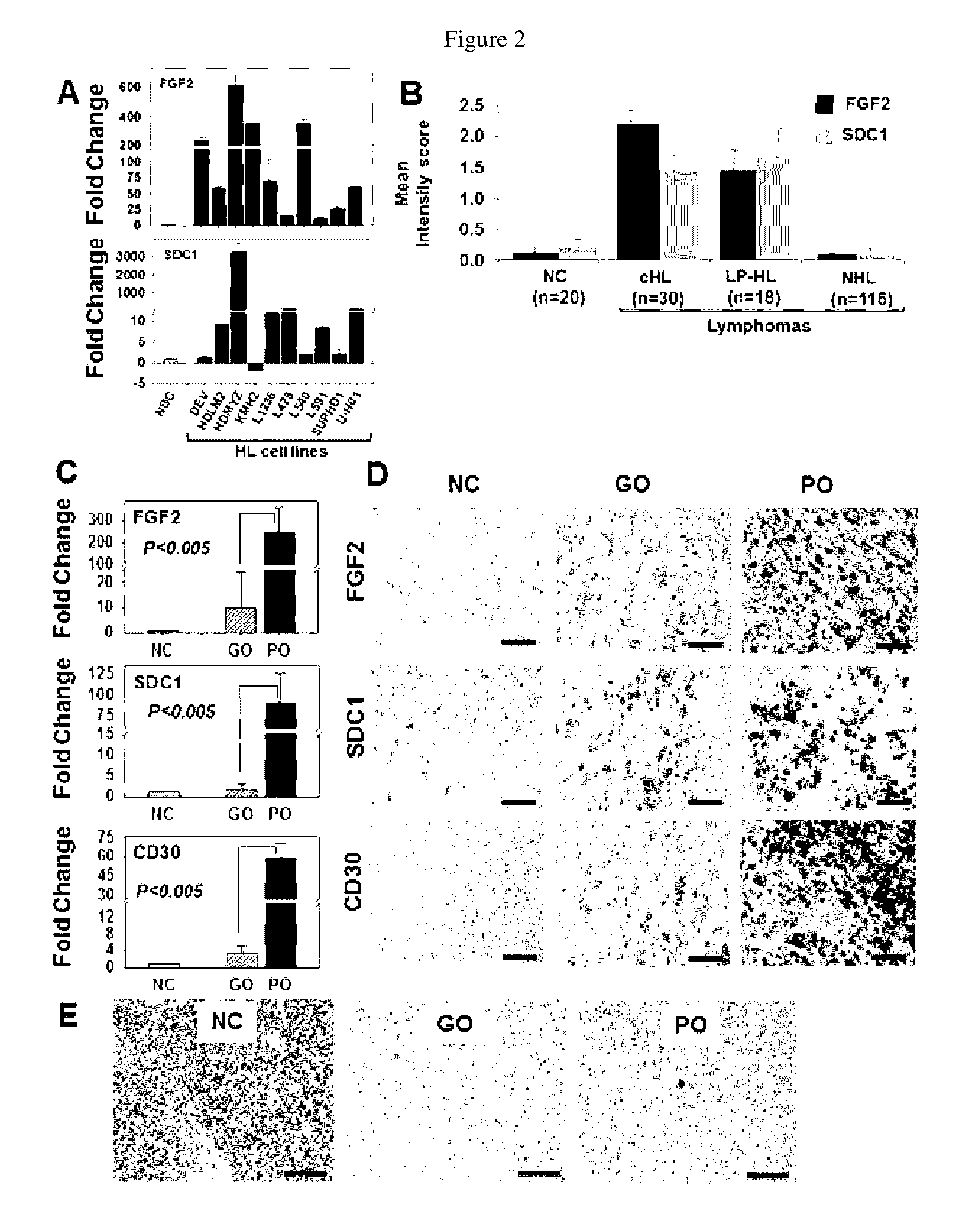 Fibroblast growth factor-2 (FGF2) and syndecan-1 (SDC1) as biomarkers for poor outcome Hodgkin lymphoma patients