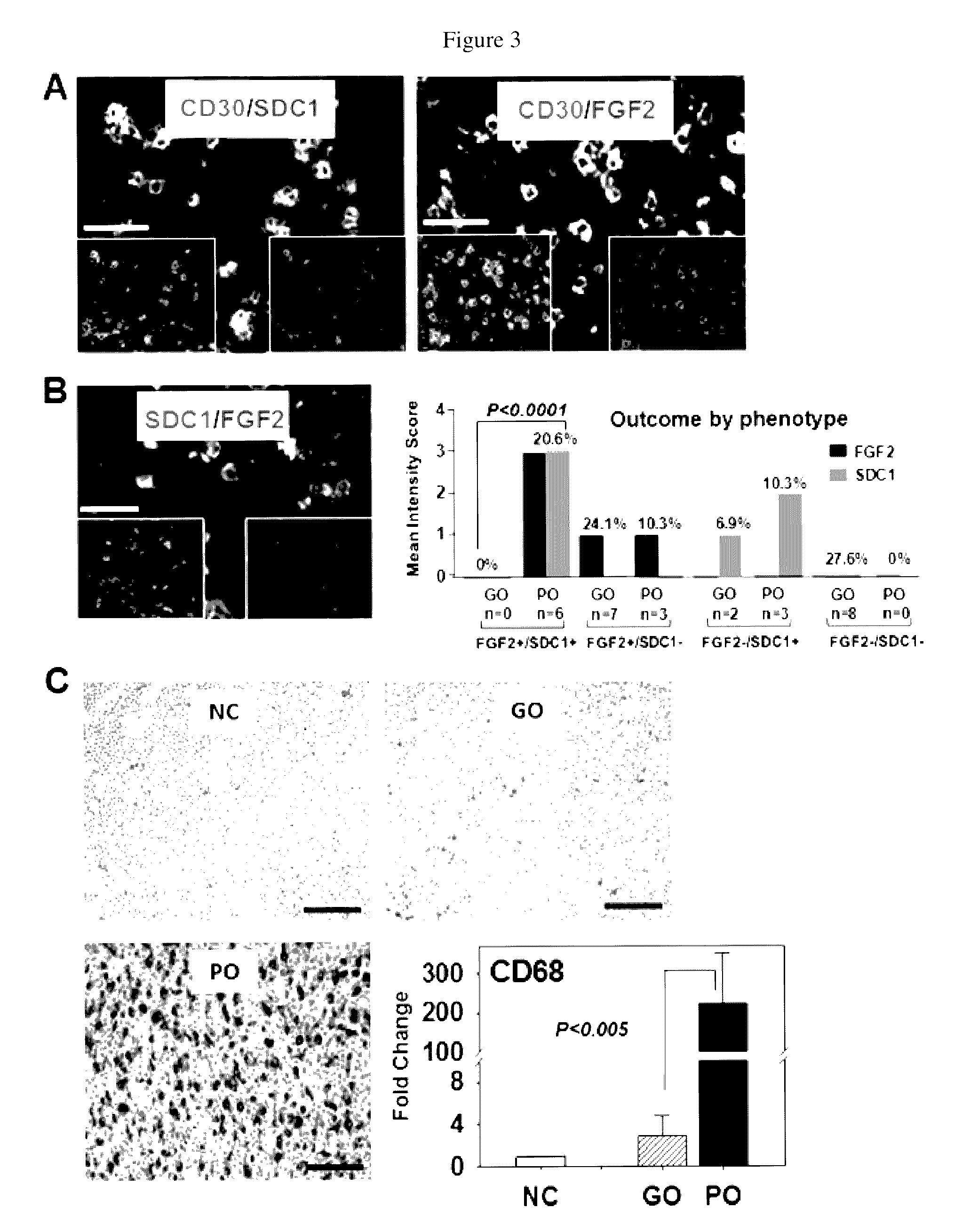 Fibroblast growth factor-2 (FGF2) and syndecan-1 (SDC1) as biomarkers for poor outcome Hodgkin lymphoma patients