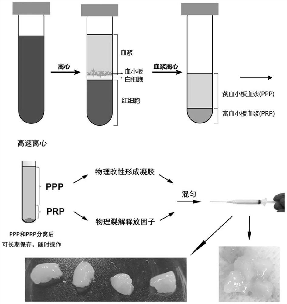 Autologous platelet factor gel as well as preparation method and application thereof