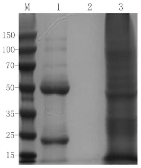 Mouse anti-human cd61 monoclonal antibody hybridoma cell line, monoclonal antibody and its preparation method and application, flow detection reagent