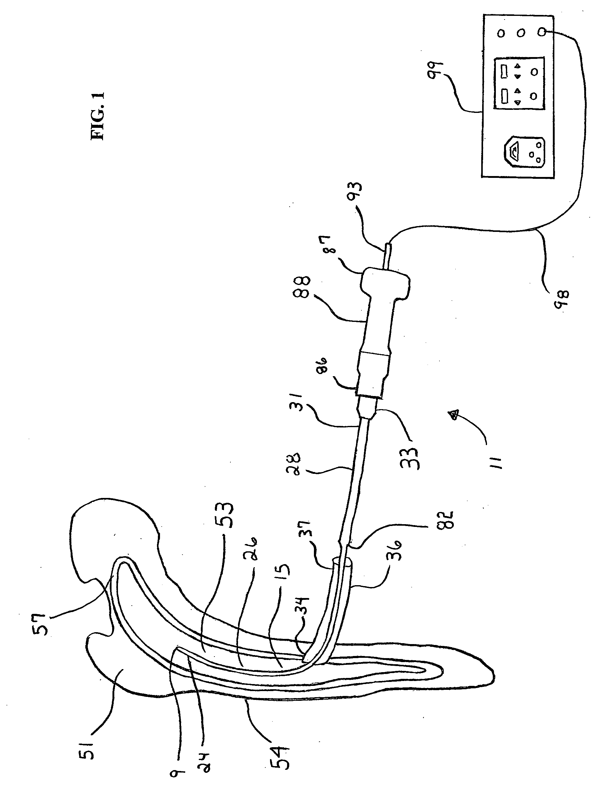 Apparatus and method for using an ultrasonic medical device to reinforce bone
