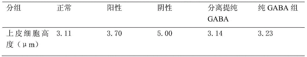 Preparation with hypothyroidism resisting effect, and preparation method thereof
