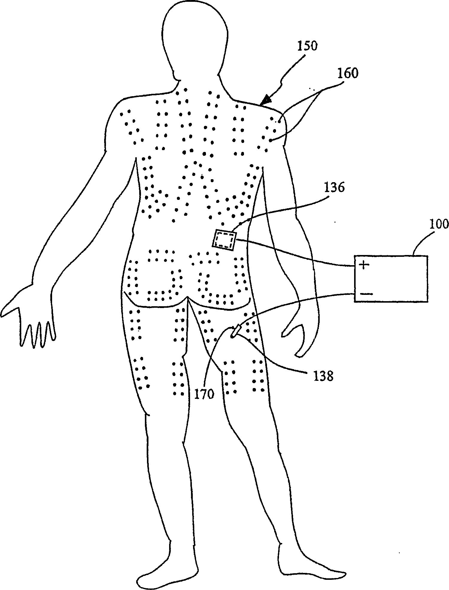 Method and device for electrochemically building of muscle