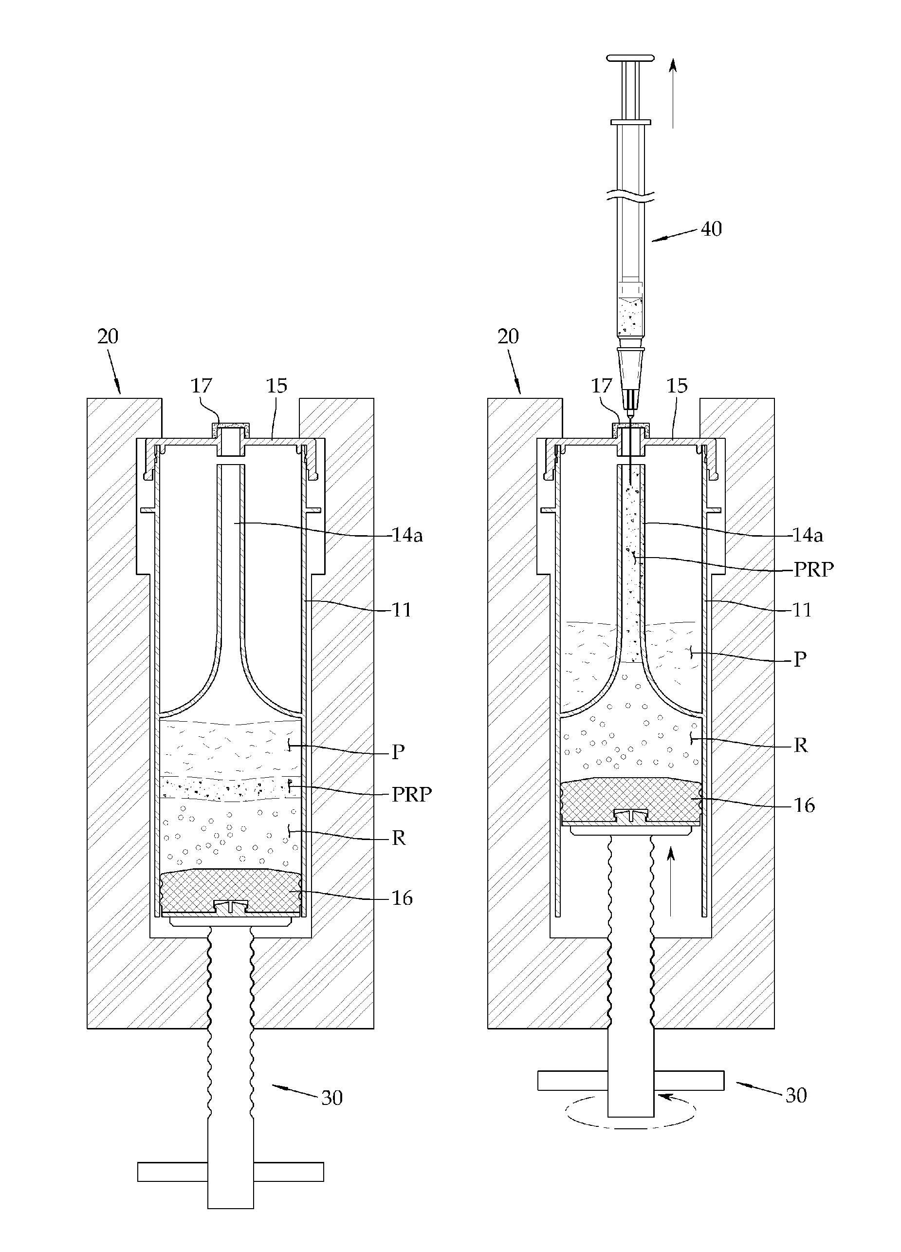 Blood separating vessel for extracting autologous platelets, and apparatus for extracting autologous platelets