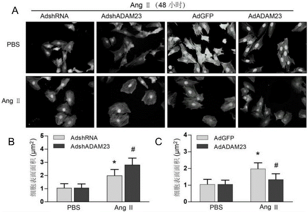 Function and application of disintegrin-metalloproteinase 23 in treatment on cardiac hypertrophy