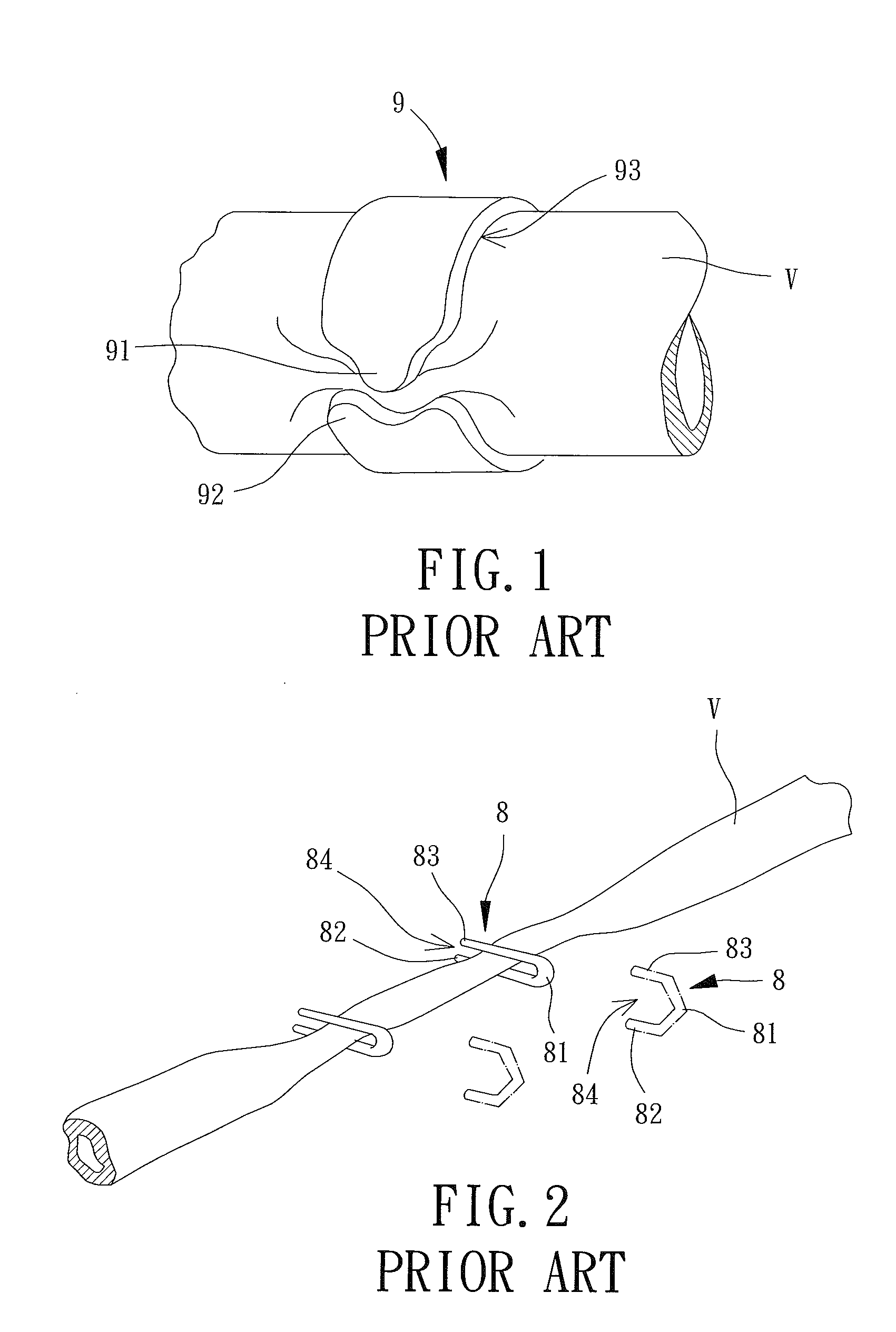 Vascular Clamp for Use in Minimally Invasive Surgery