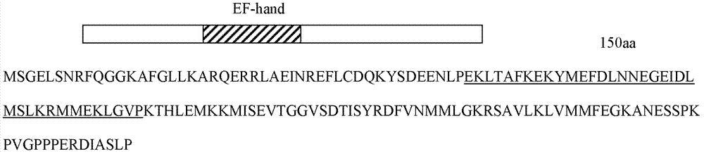 Application of protein coded by gene LIMG and antibody thereof in breast cancer diagnosis and/or treatment