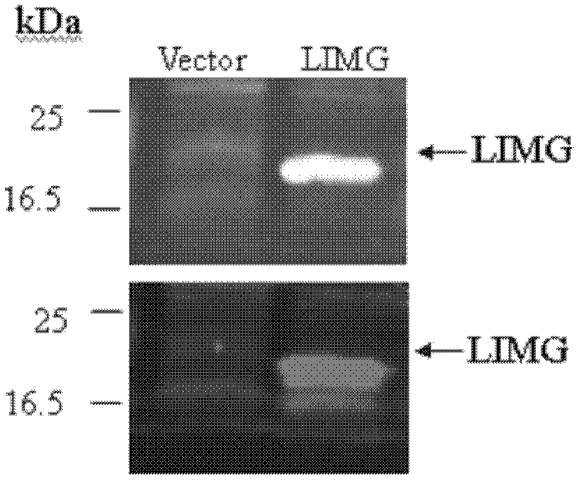 Application of protein coded by gene LIMG and antibody thereof in breast cancer diagnosis and/or treatment
