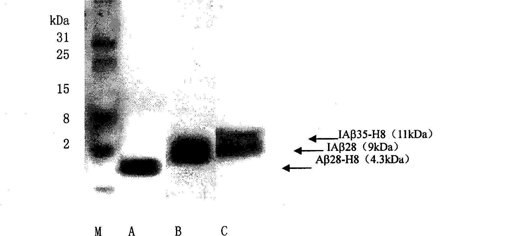 Recombinant antigen polypeptide for treating Alzheimer's disease and polypeptide gene