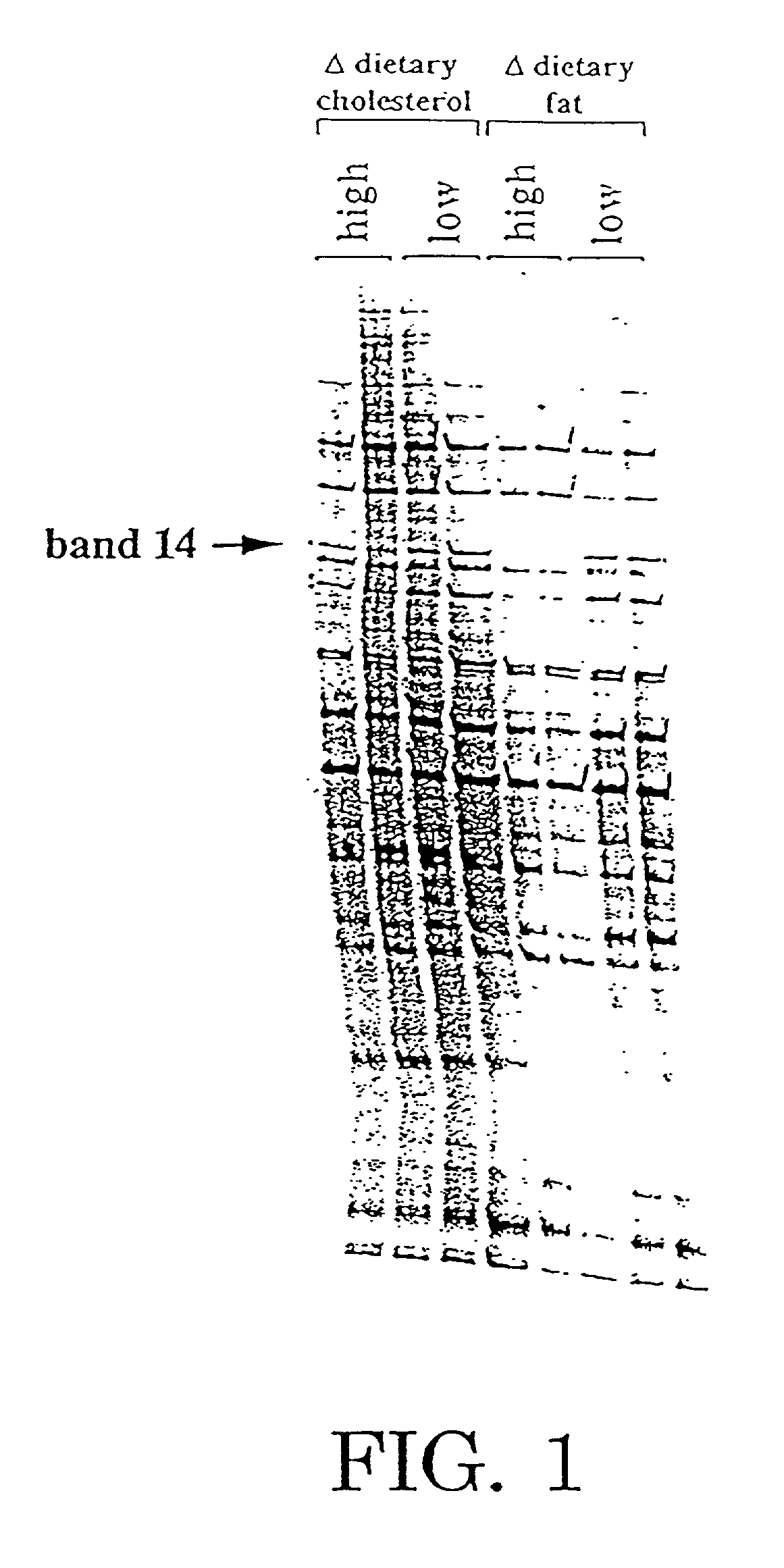Compositions and methods for the treatment and diagnosis of cardiovascular disease
